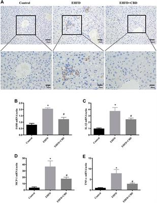 CBD Alleviates Liver Injuries in Alcoholics With High-Fat High-Cholesterol Diet Through Regulating NLRP3 Inflammasome–Pyroptosis Pathway